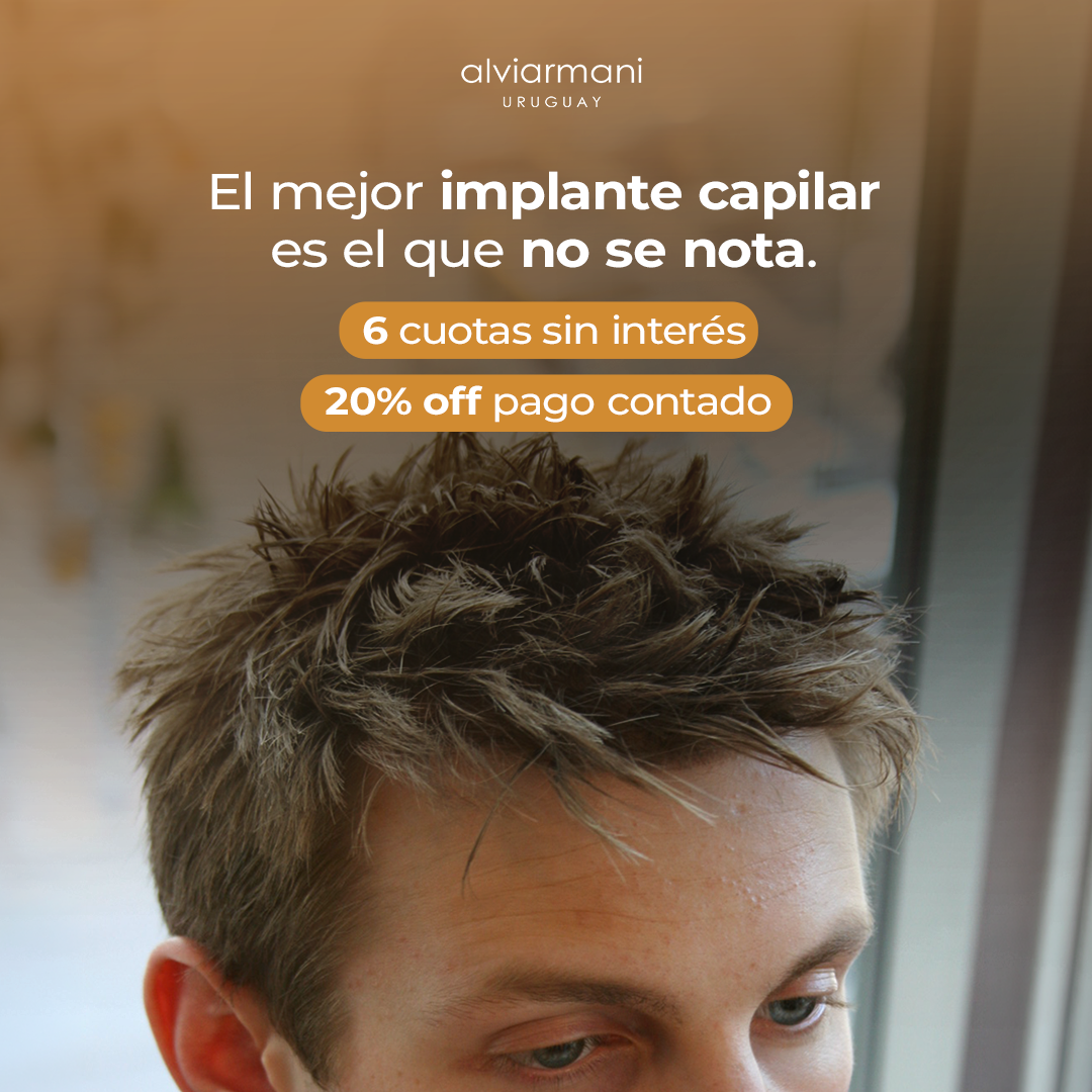 Alvi Armani Uruguay Facebook ad: Recuperá tu cabello