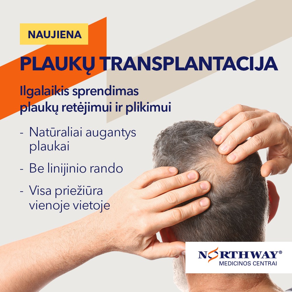 Northway medicinos centrai Facebook ad: , medicinos centre jau atliekama FUE plaukų transplantacija.
