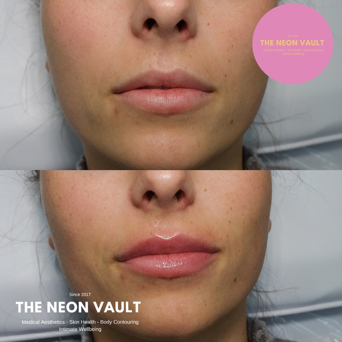 The Neon Vault Facebook ad