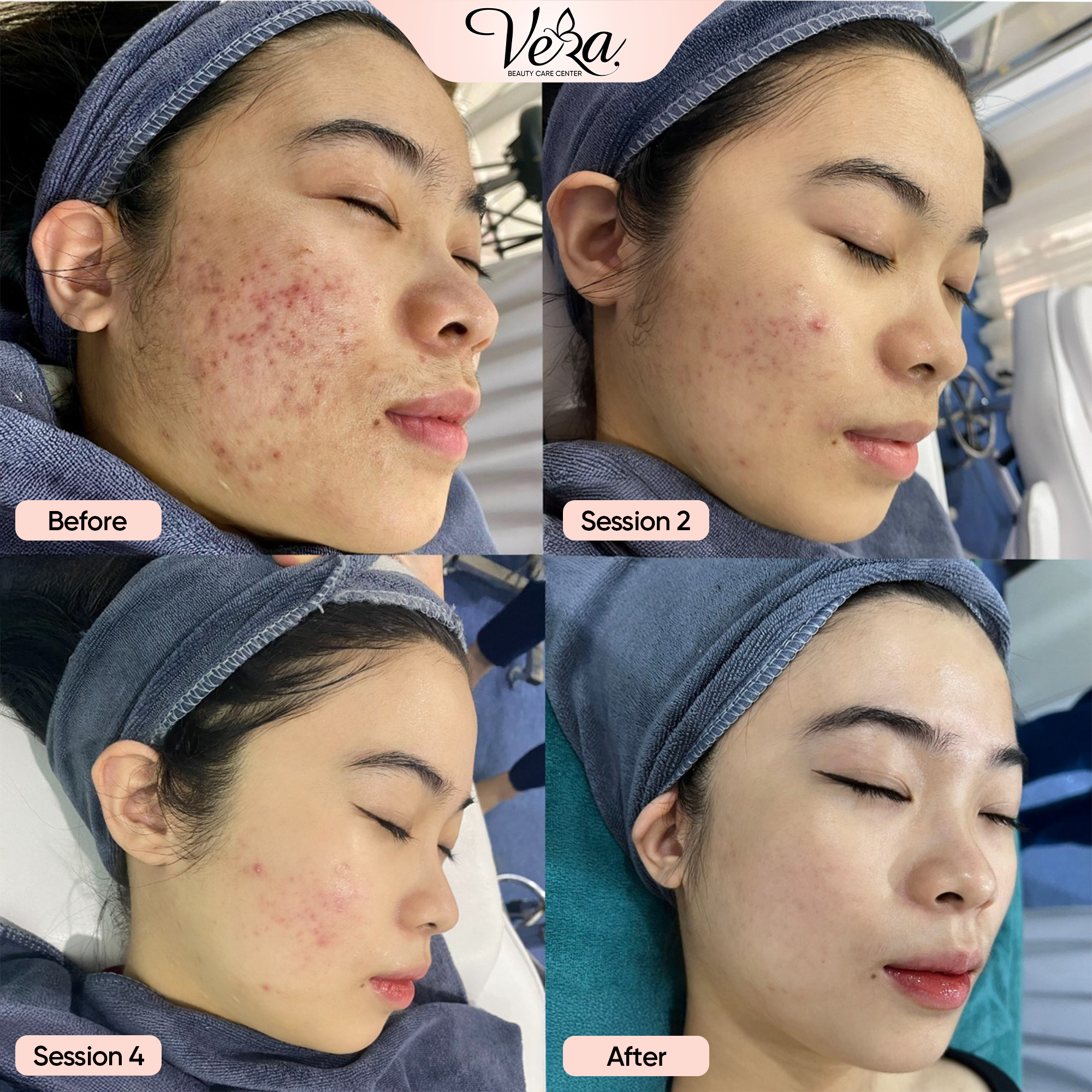 Vera Beauty Care Center Facebook ad