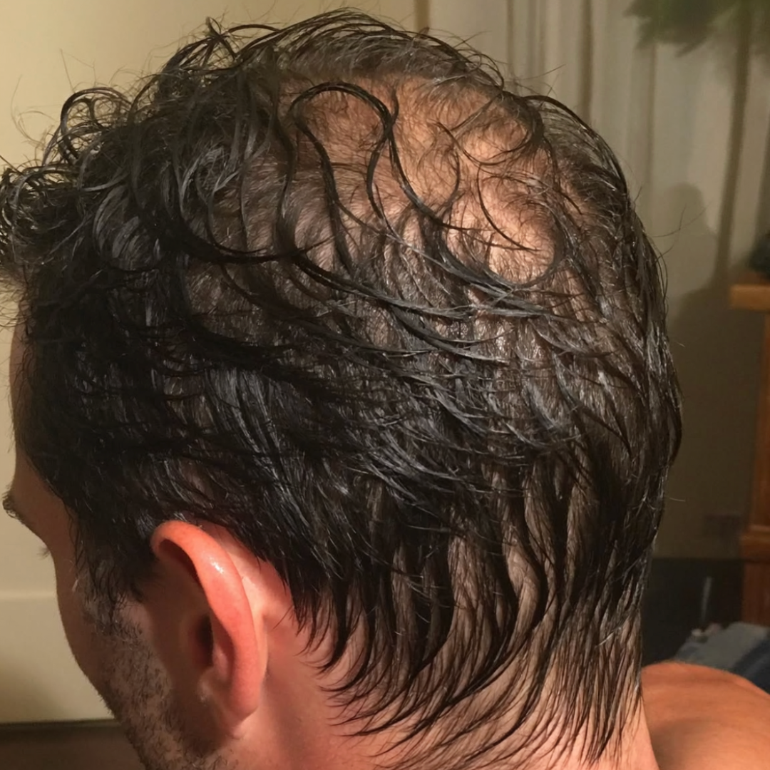 Dr. Alex Hair Expert Facebook ad