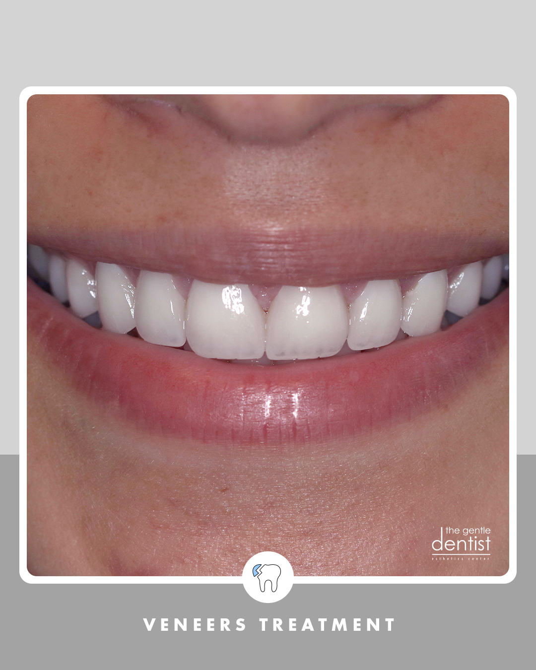 The Gentle Dentist Facebook ad