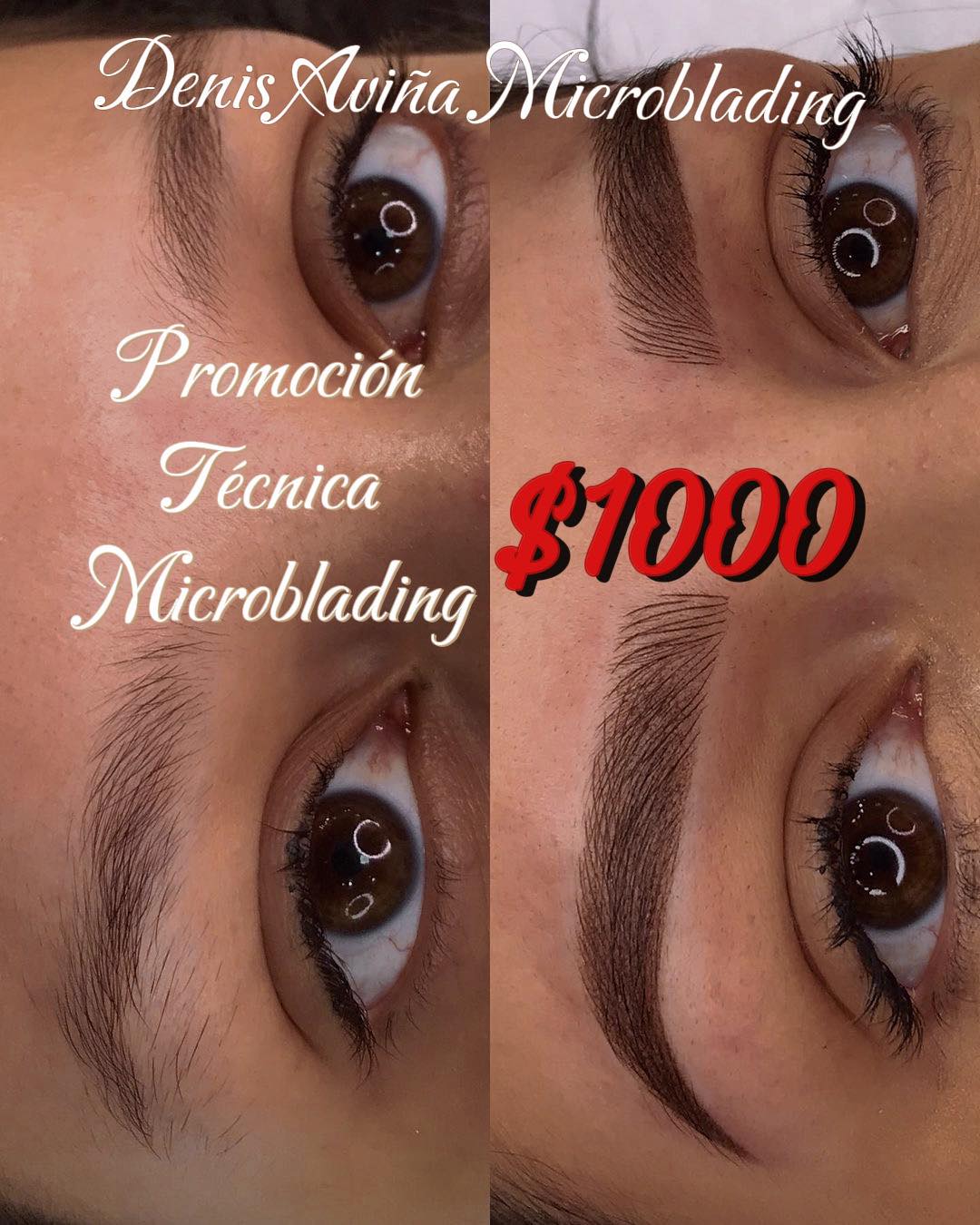 Denis Aviña cejas y láser Facebook ad