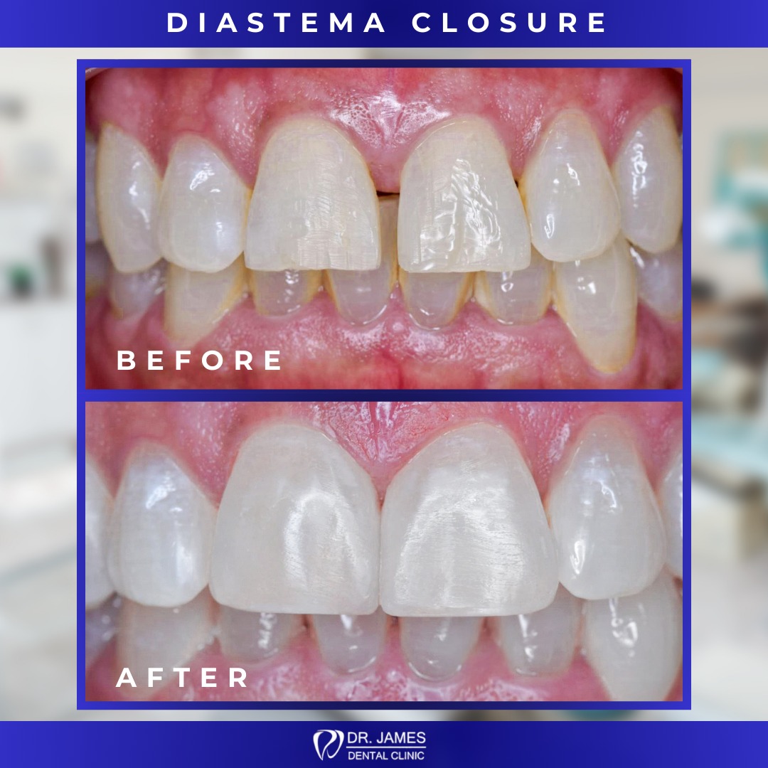 Dr. James Dental Clinic Facebook ad
