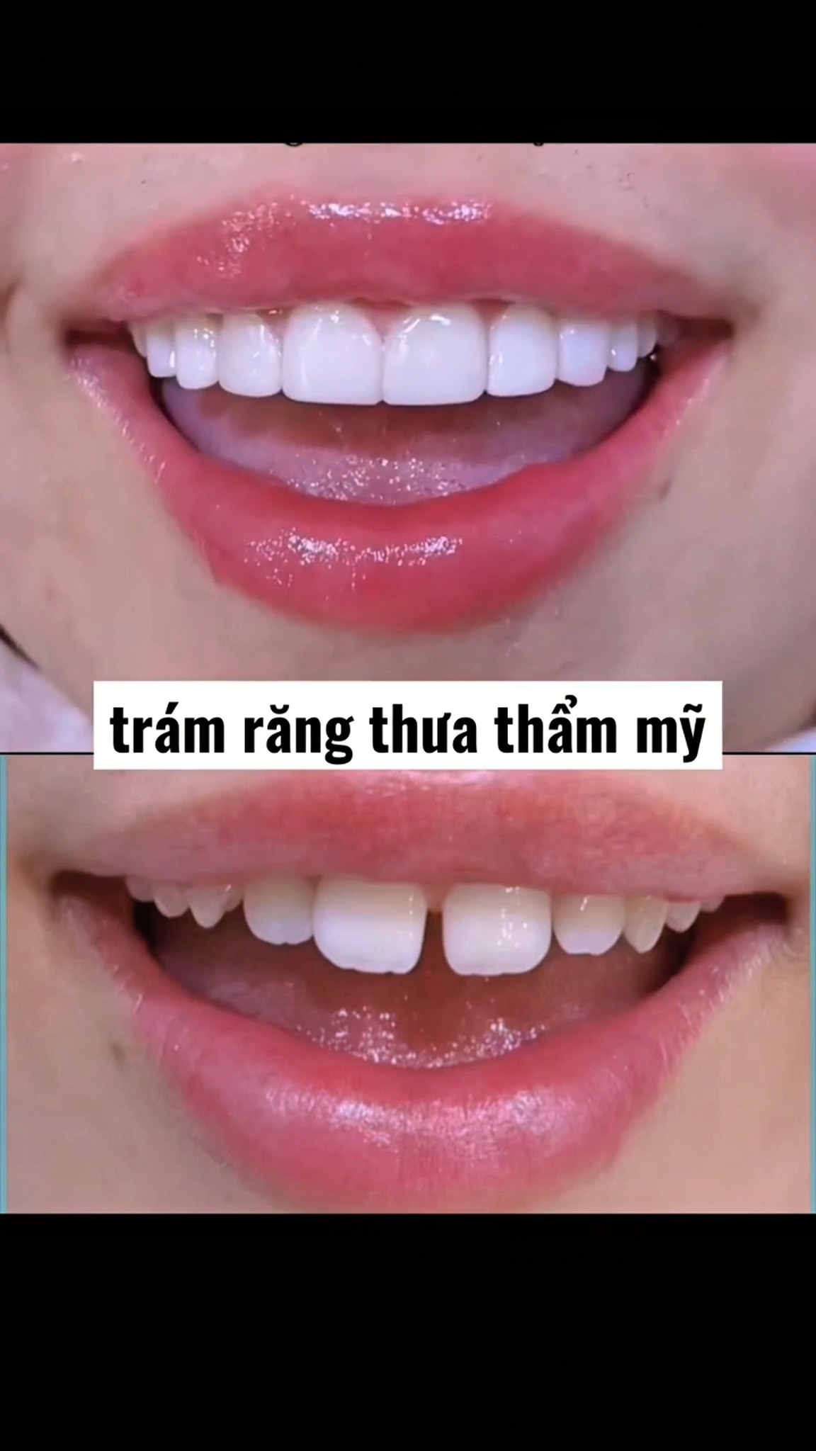 Nha Khoa Willy Hải Phòng Facebook ad: 299K SMILE DESIGN CHỈ VỚI 299K/1 RĂNG