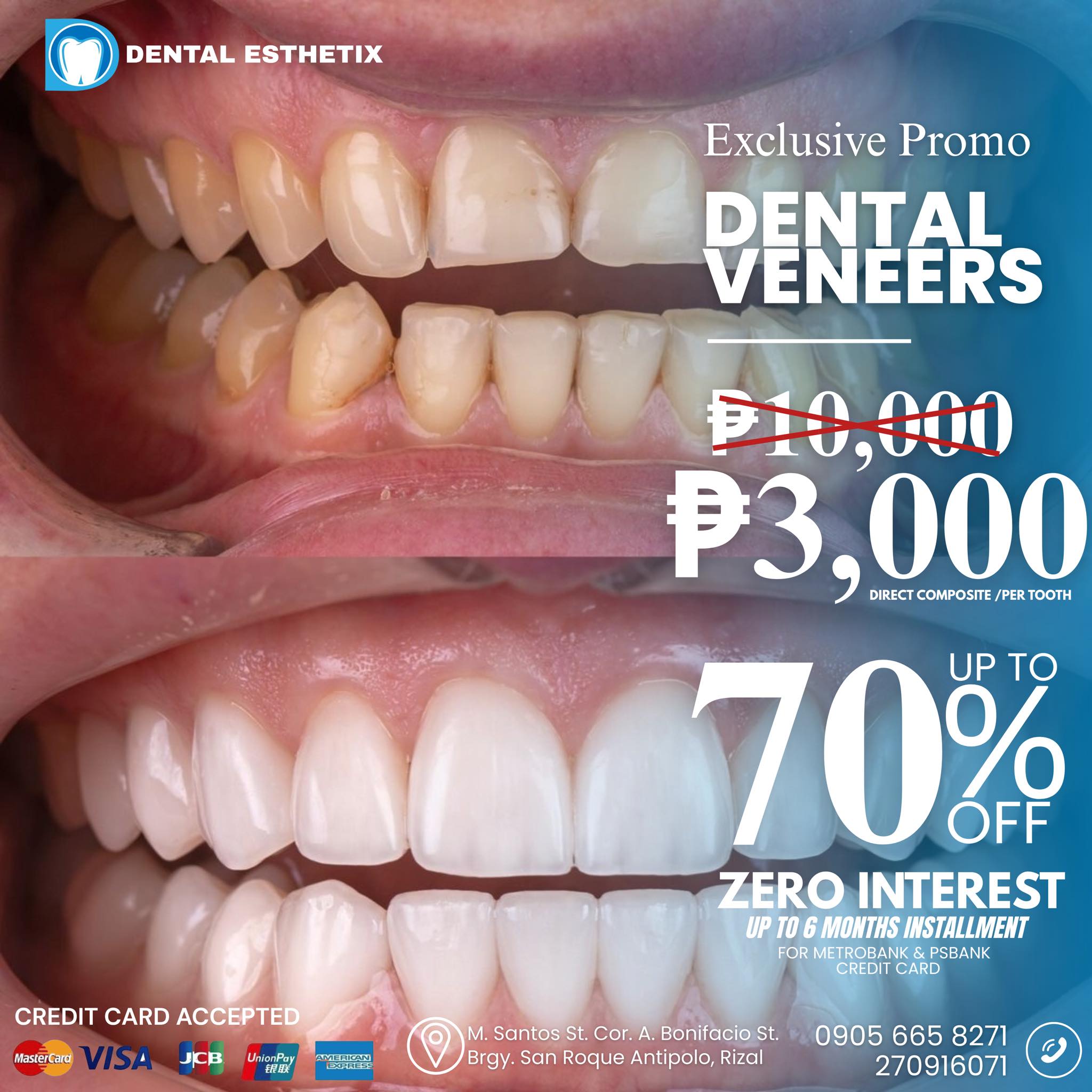 Dental Esthetix - Antipolo Facebook ad: ๐๐จ๐ฎ๐ซ ๐๐ซ๐๐๐ฆ ๐๐ฆ๐ข๐ฅ๐, ๐๐จ๐ฐ ๐๐จ๐ซ๐โฆ