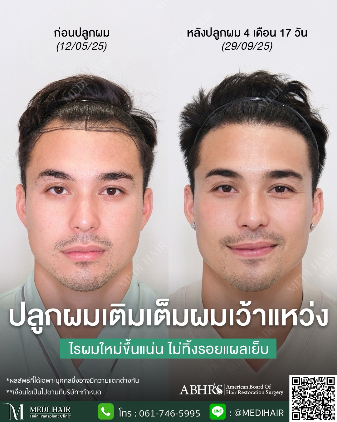 MEDI HAIR Facebook ad