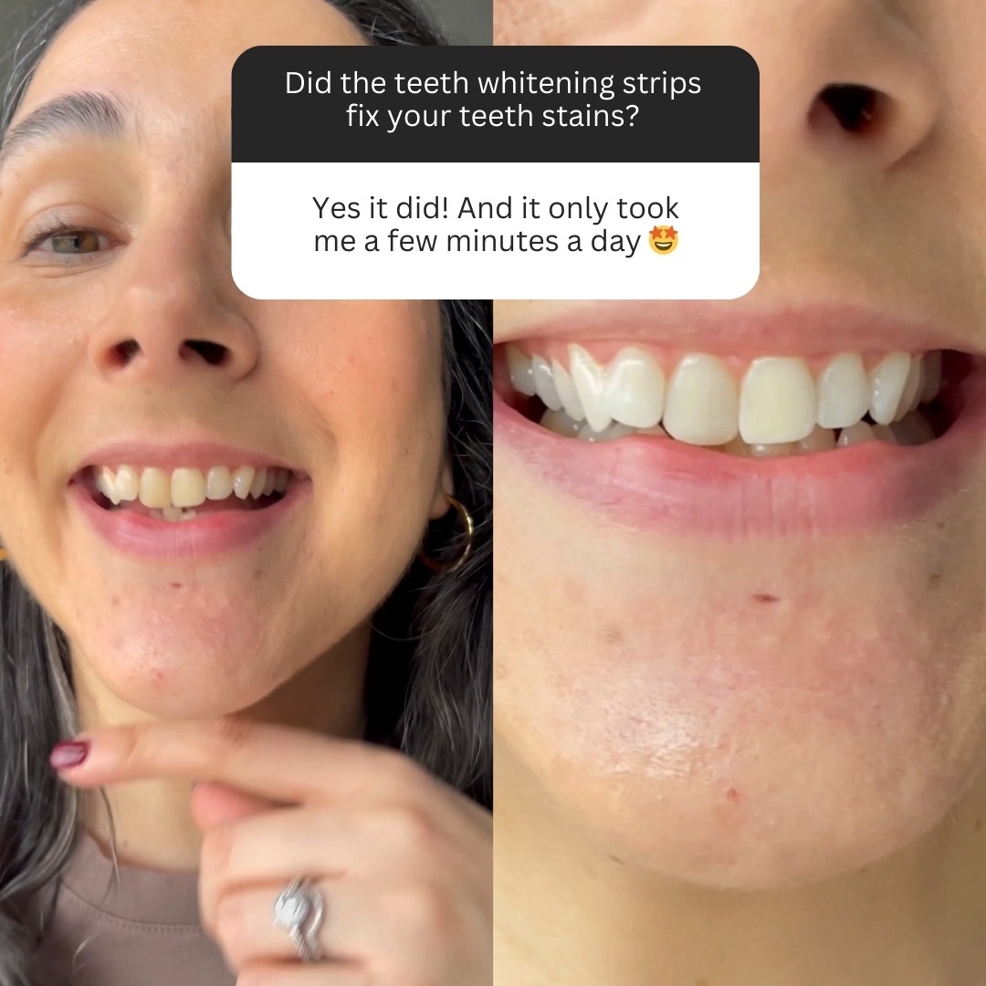 HeySmile Facebook ad