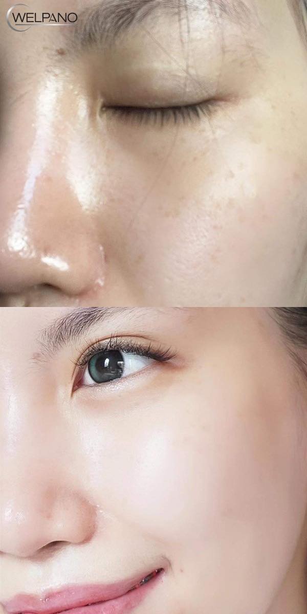 Welpano Cosmetics : เวชสำอางโดยเภสัชกร Facebook ad