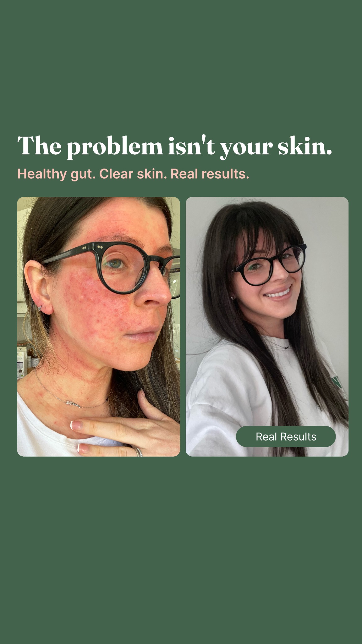 Hanna Sillitoe Facebook ad from Jun 9, 2026