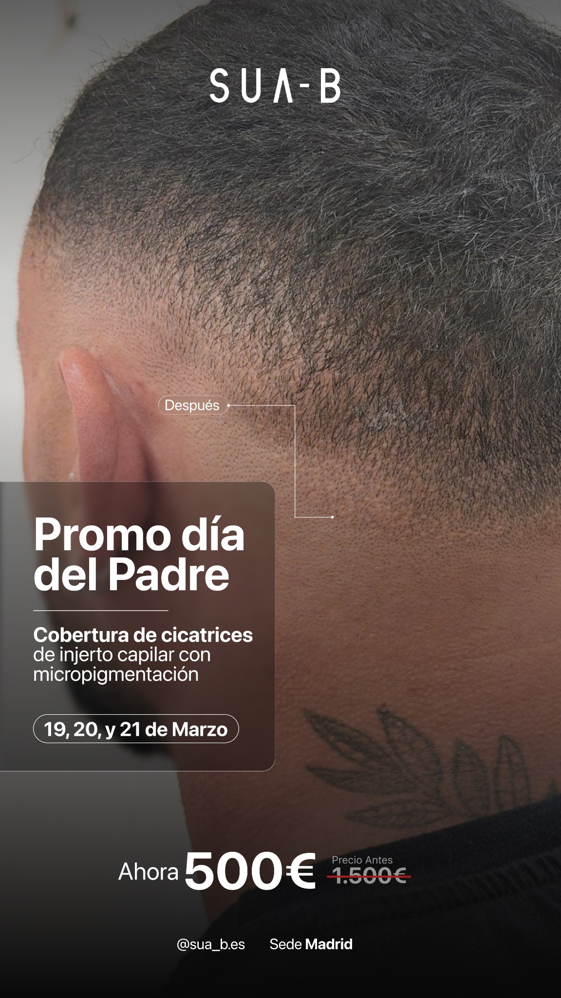 SUA-B Atocha Facebook ad from Mar 16, 2026