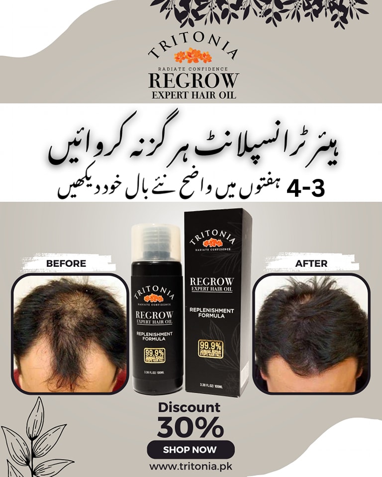 Tritonia Facebook ad: گرتےہوئے بالوں سے پریشان اور گنج پن کا…