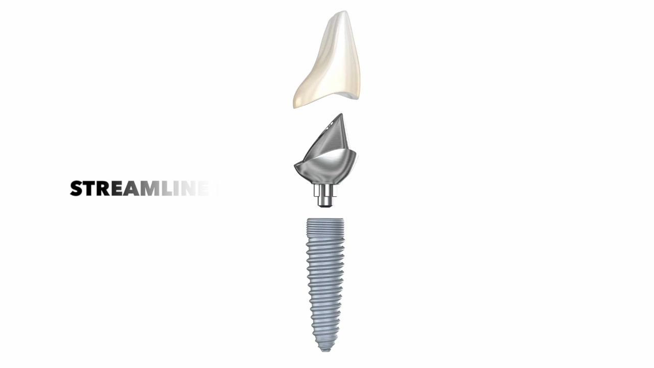 Streamline Dental Implants Facebook ad: Discover what’s possible-schedule your Dental Implant…