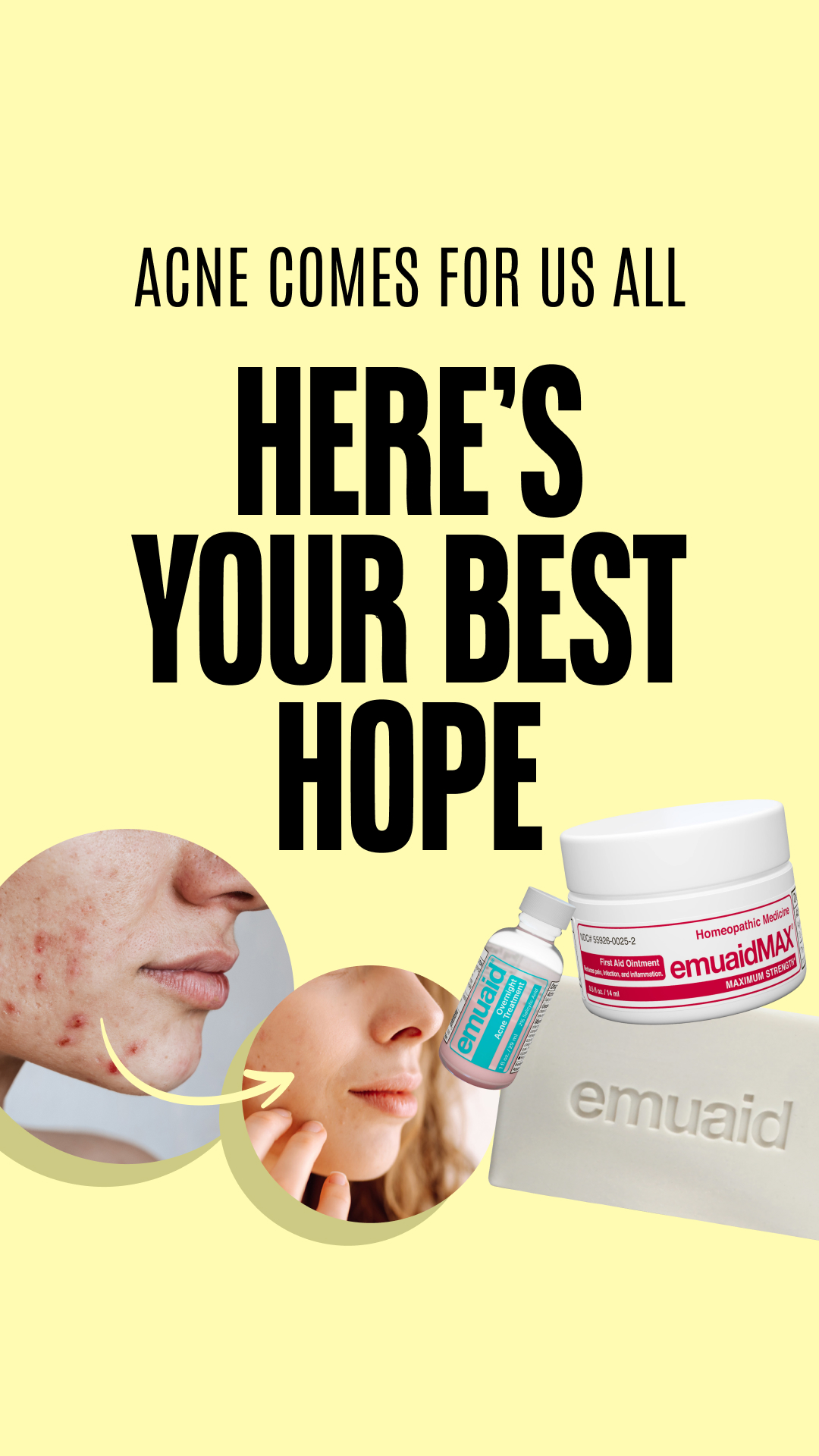 Emuaid Facebook ad