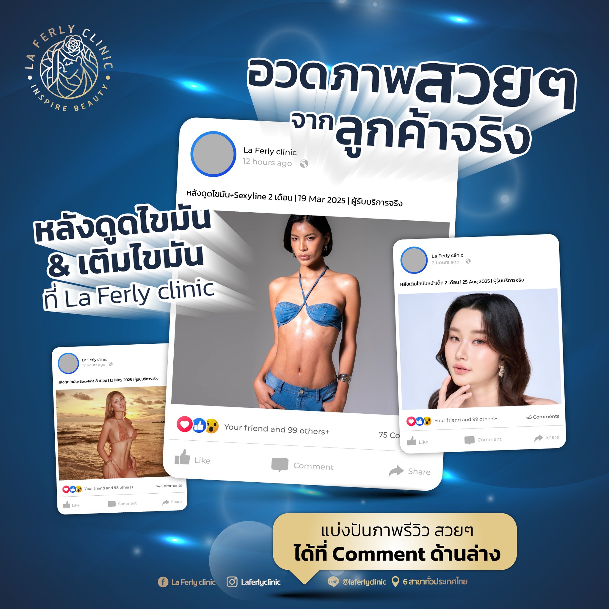 La Ferly clinic Facebook ad