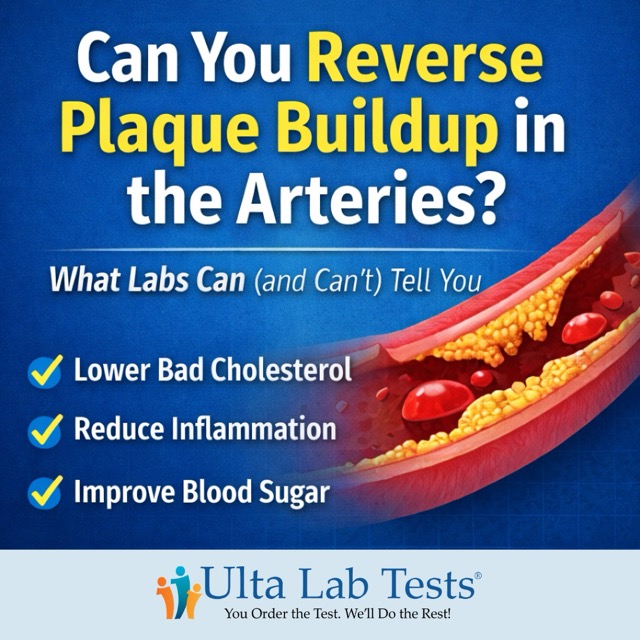 Ulta Lab Tests Facebook ad: Can You Reverse Plaque Buildup in the Arteries? What Labs…