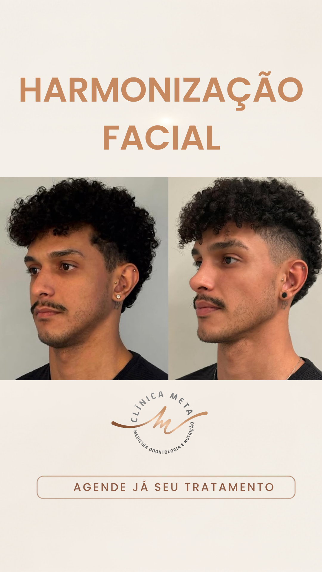 Clínica META - Medicina Integrativa e Estética Facebook ad from Jul 7, 2026