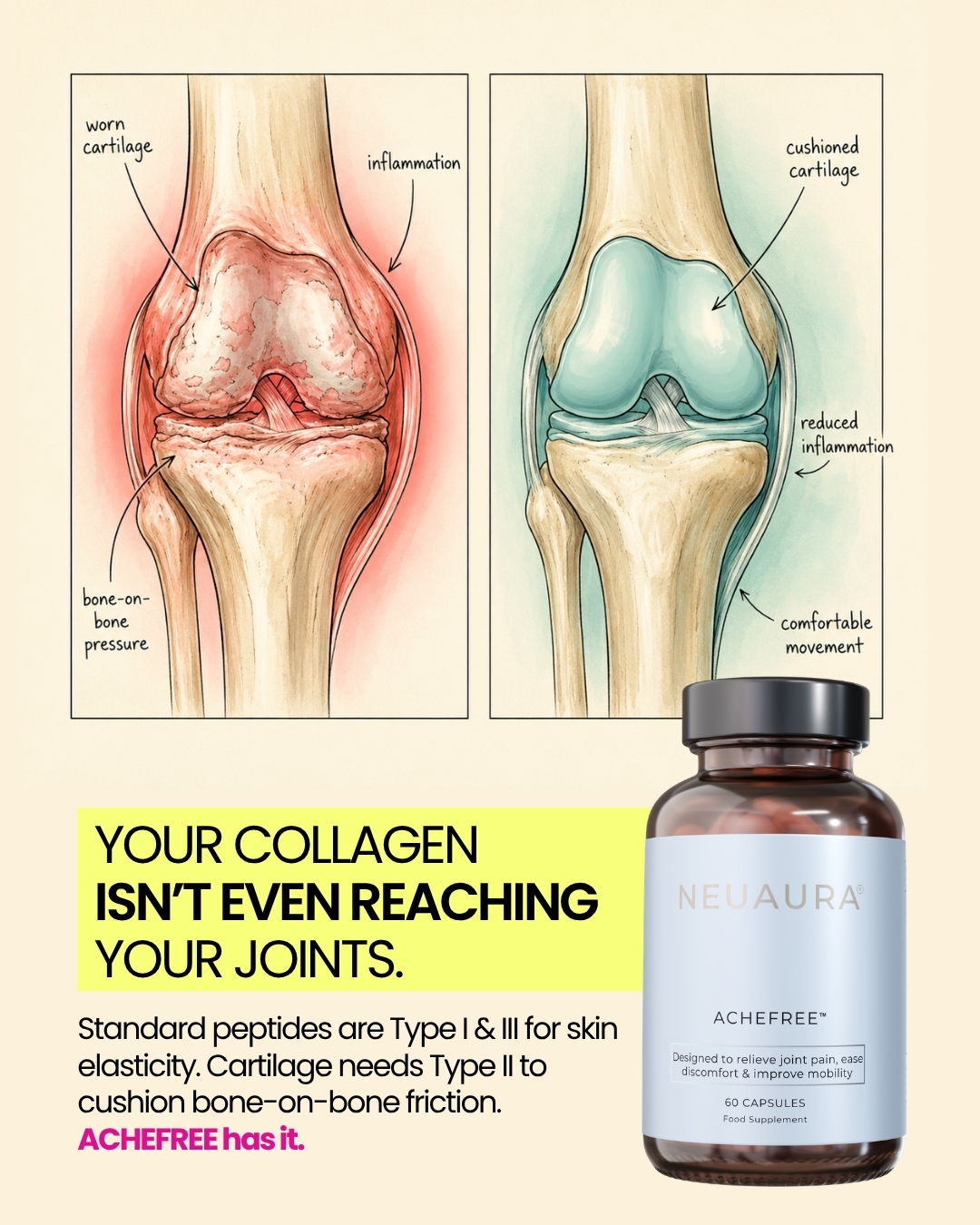Neuaura Facebook ad