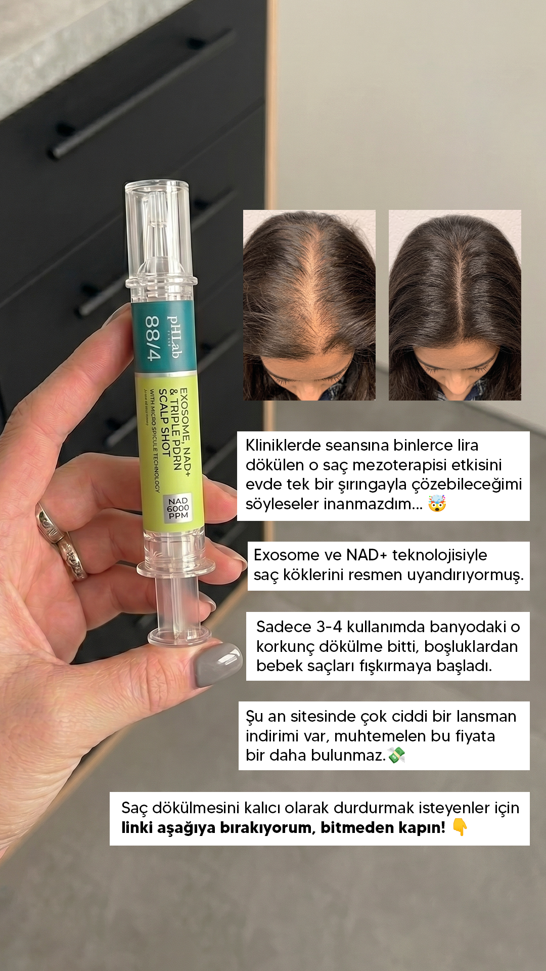 PHLAB-ScalpShot Facebook ad: Yoğun Scalp Bakımı