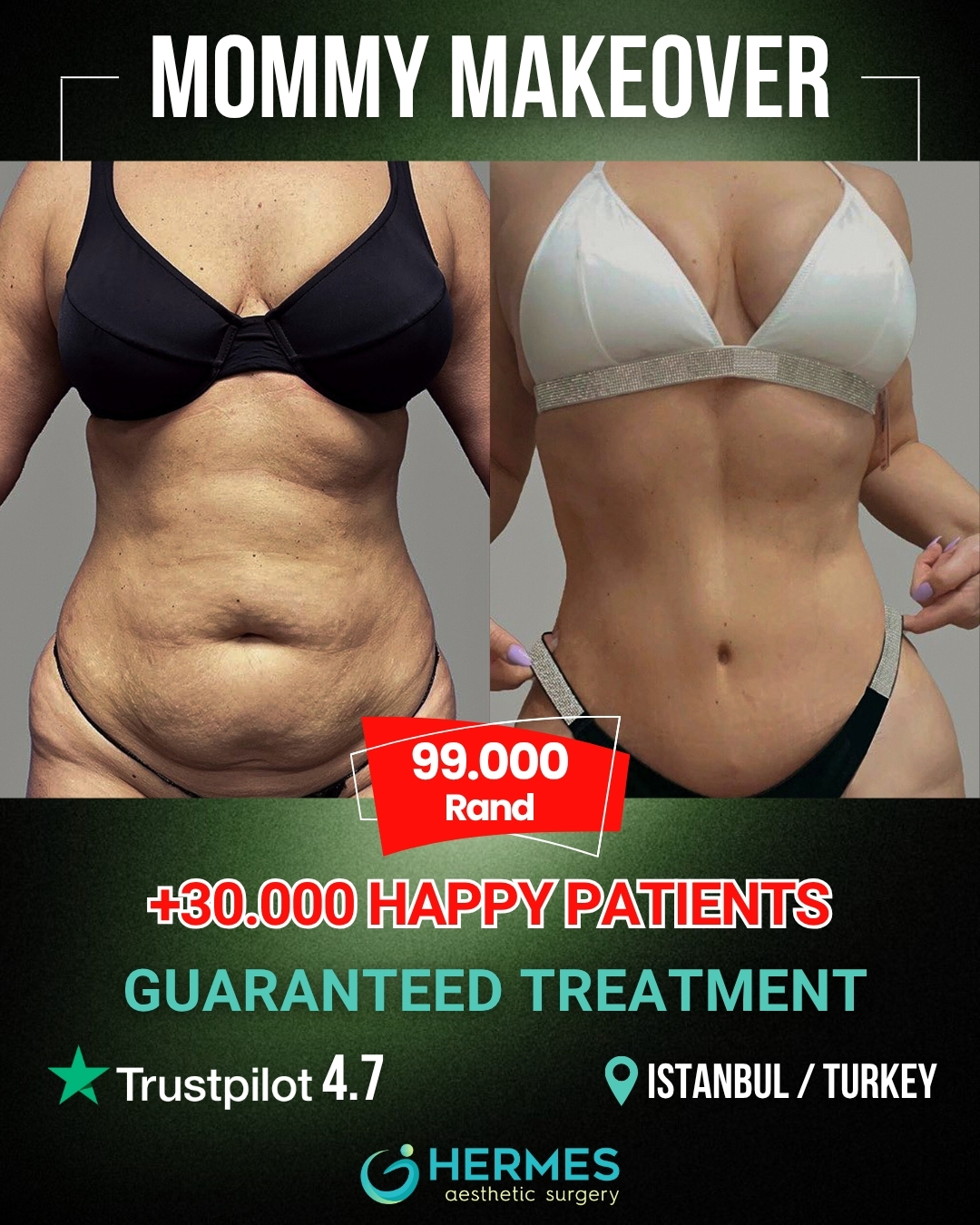 Hermes Clinics Facebook ad