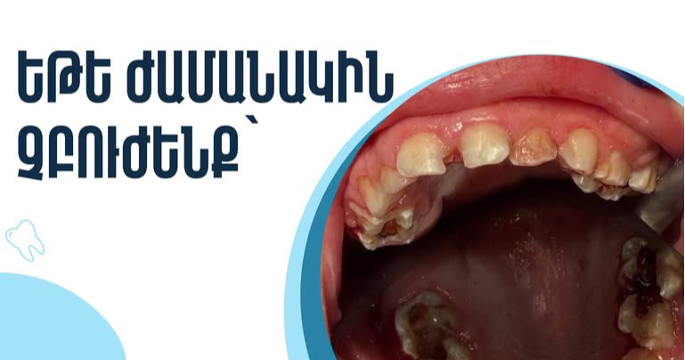 Dr. smile Facebook ad