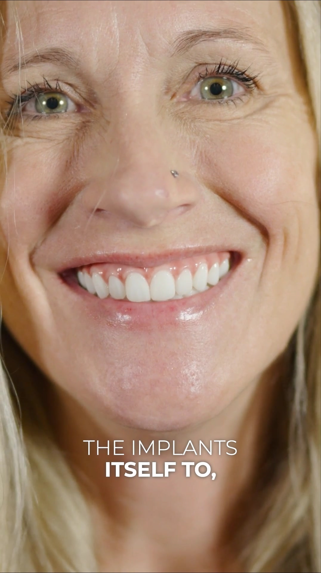 Nuvia Dental Implant Center Facebook ad: New Permanent Teeth Are Just 24 Hours Away!
