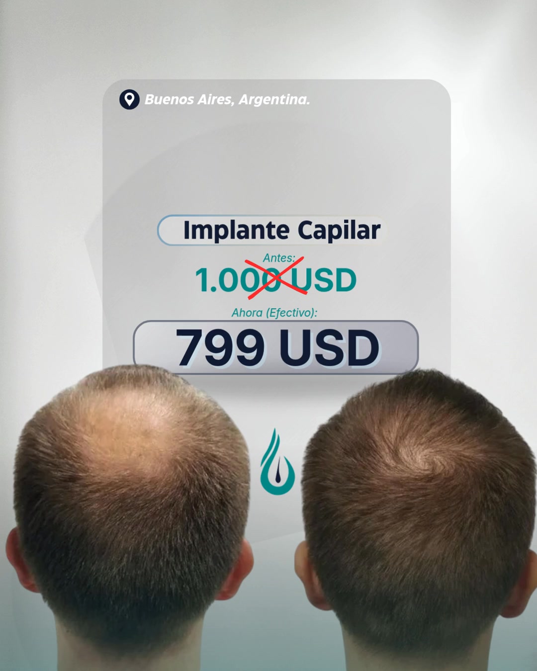 Dermis Capilar Facebook ad: Hacé el cambio hoy