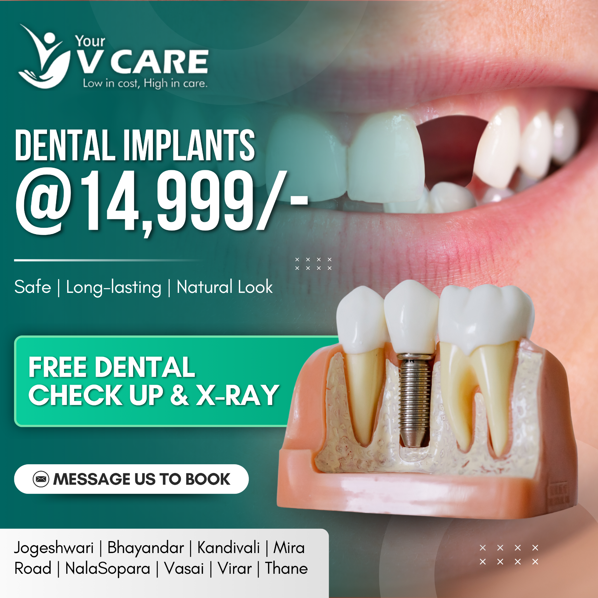 Your V Care Dental Clinic & Hospital Facebook ad: That one missing tooth… you notice it every…