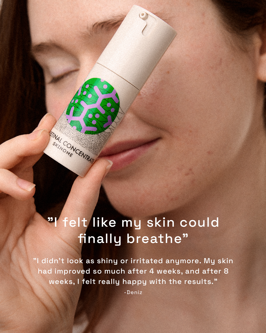 Skinome Facebook ad