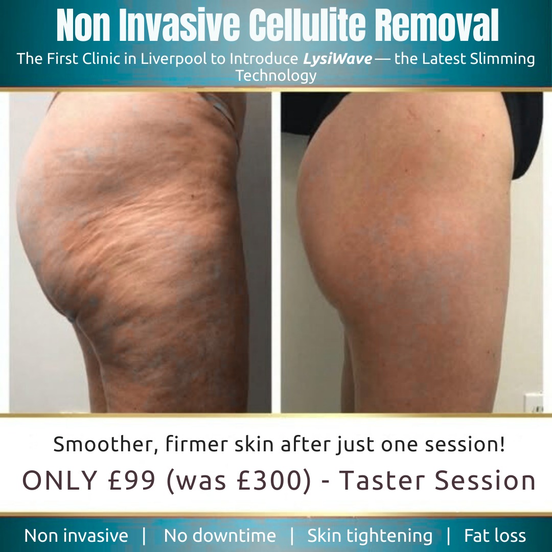 Derma Cosmedic Aesthetics of Liverpool Facebook ad
