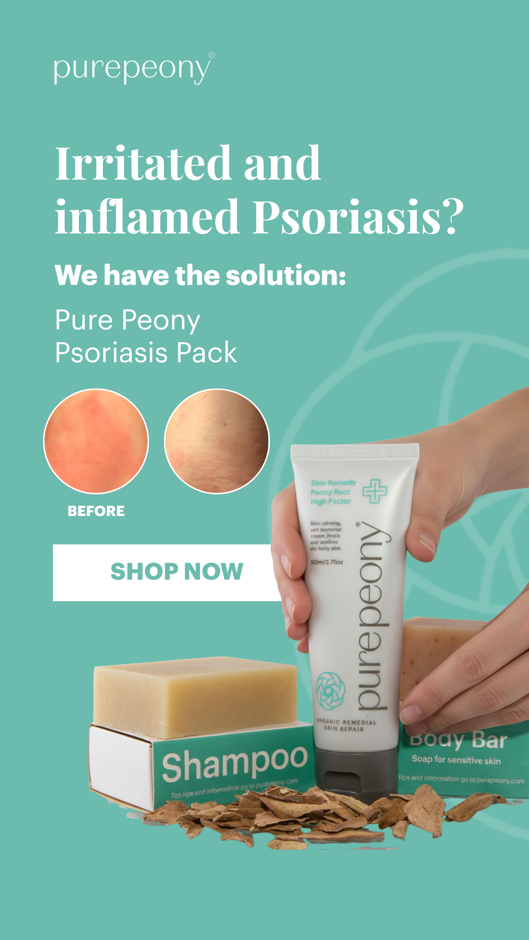 Pure Peony Facebook ad from Feb 26, 2026