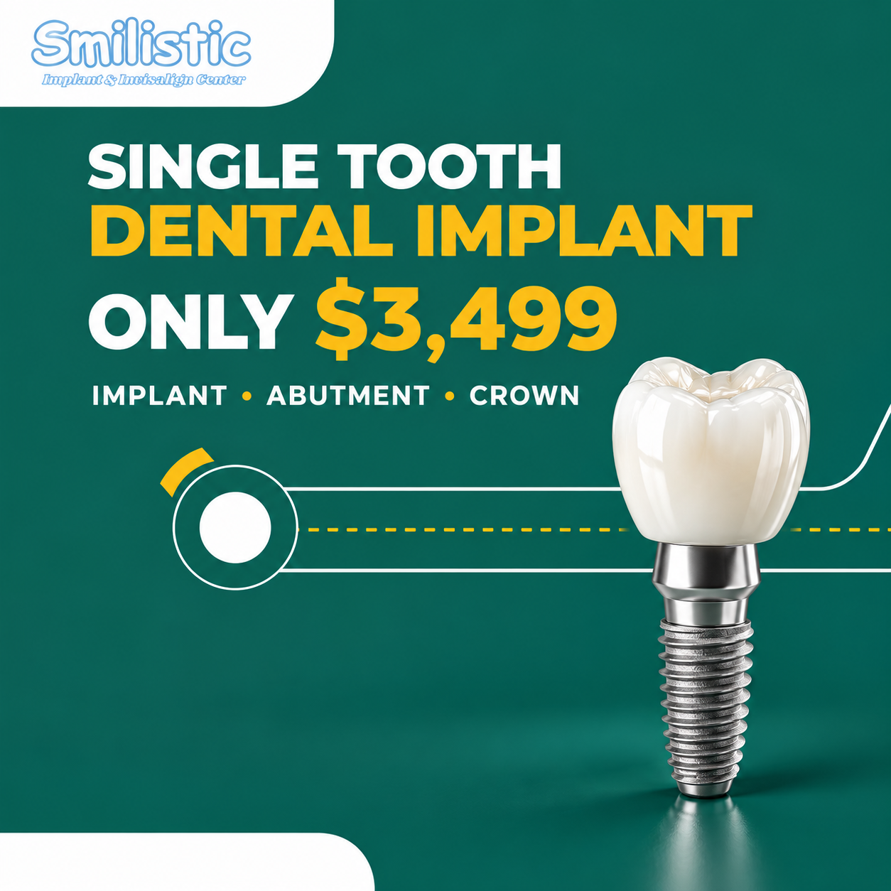Smilistic Dental Care of Marlborough Facebook ad: Marlborough - Single Tooth Implants at $3,499!