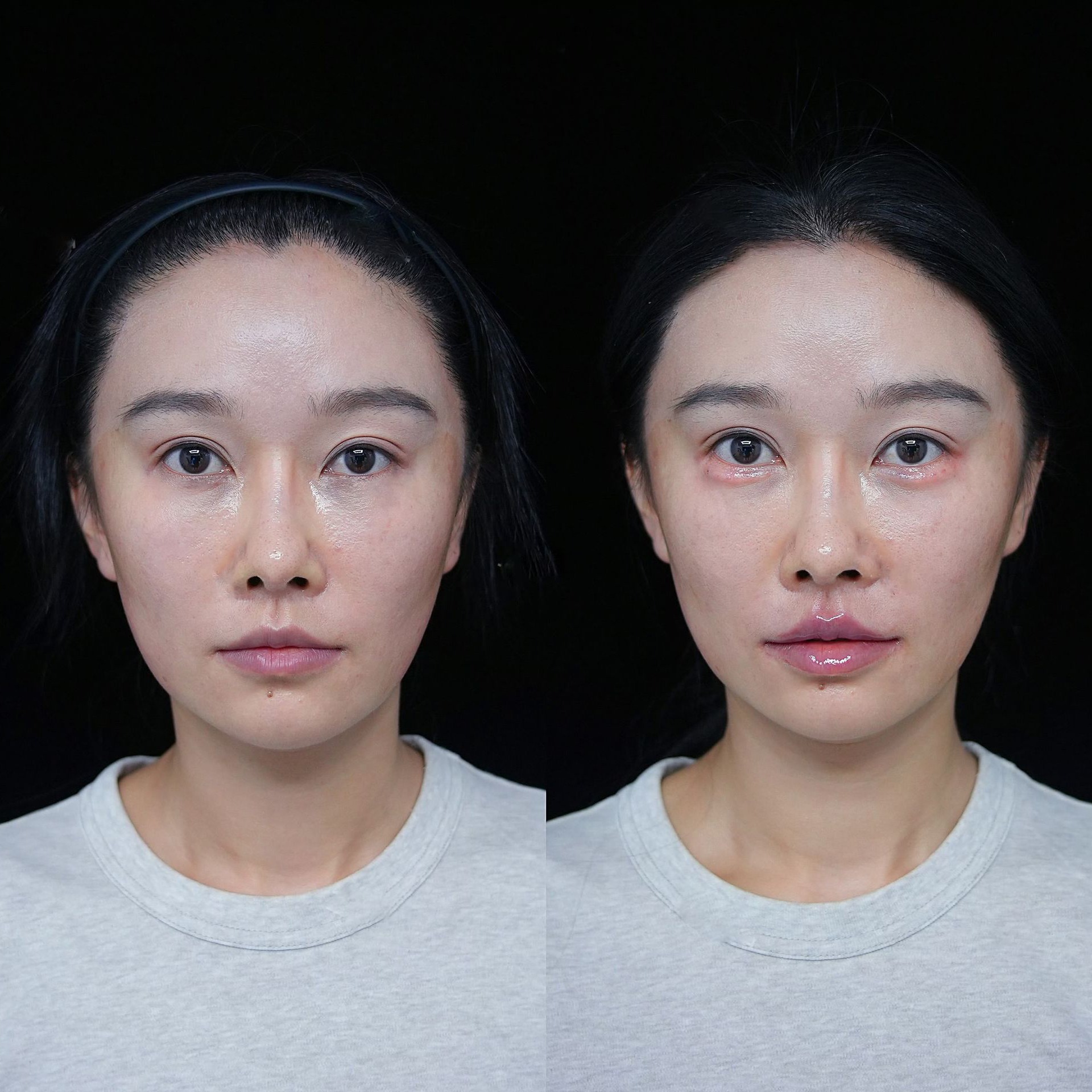 Guangzhou Cosmetic Clinic Facebook ad