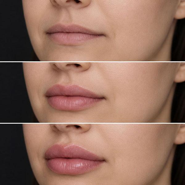 Dr. Olivia Bennett Facebook ad: Ditch the Lip Fillers: The Natural Way to Plump