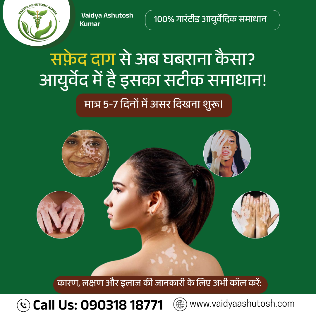 Vaidya Ashutosh Kumar Facebook ad: सफेद दाग और Psoriasis से परेशान हैं?