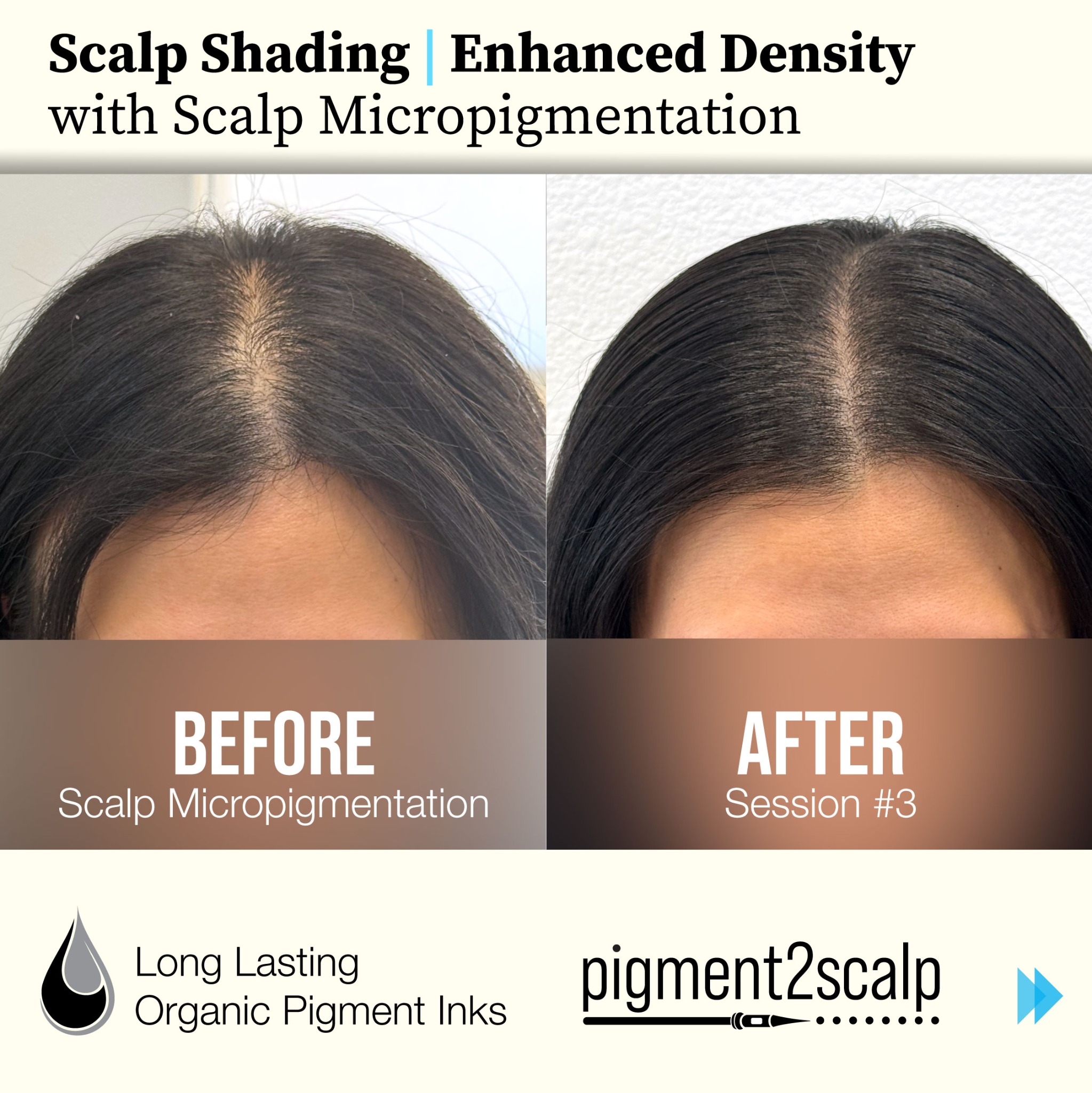 Pigment2scalp Micropigmentation Facebook ad: San Diego Women: Are you tired of seeing…