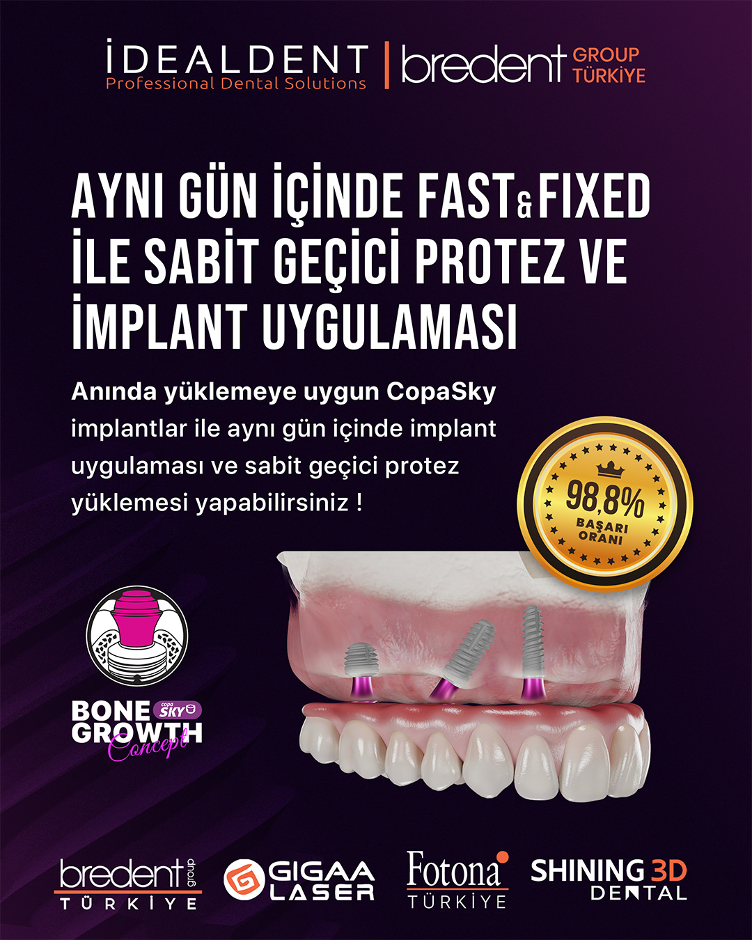 Bredent Tr Facebook ad