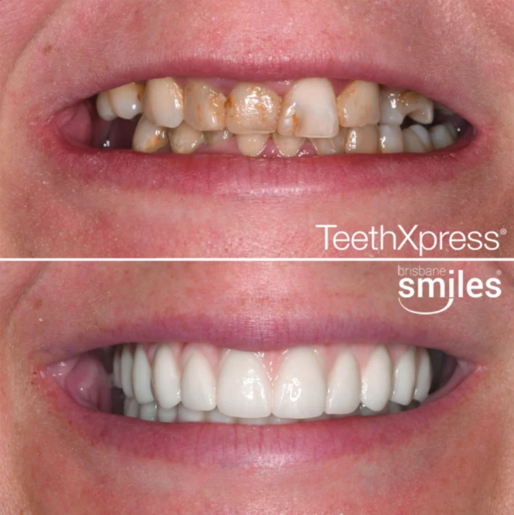 Brisbane Smiles Facebook ad