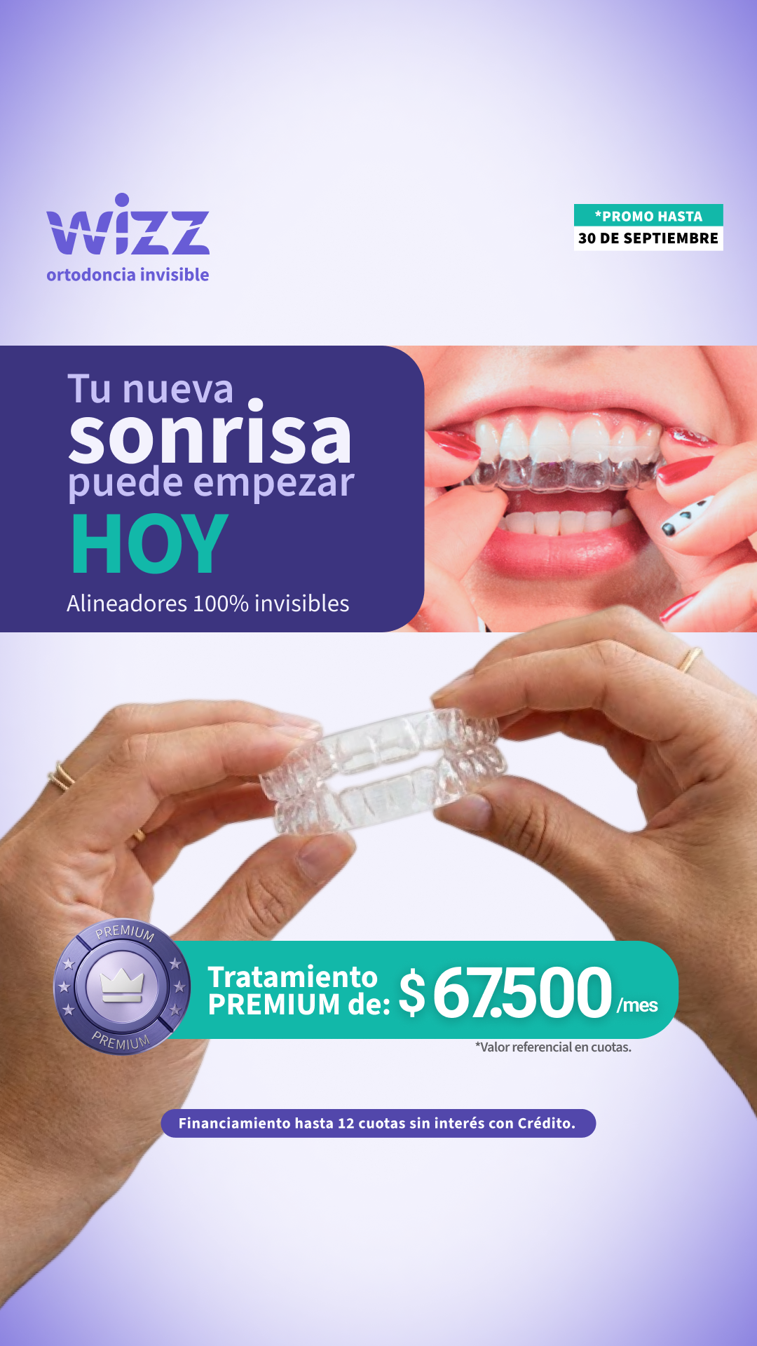 Wizz Chile Facebook ad: Alineadores en cuotas | 6 cuotas *Sin tarjeta de crédito*