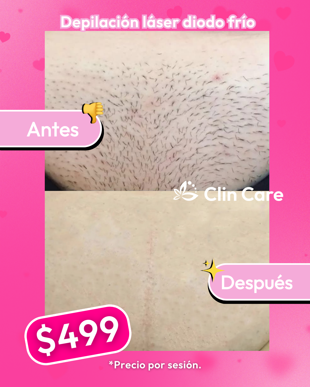 Clin Care - Depilacion laser & Med Spa Facebook ad from Jan 29, 2026