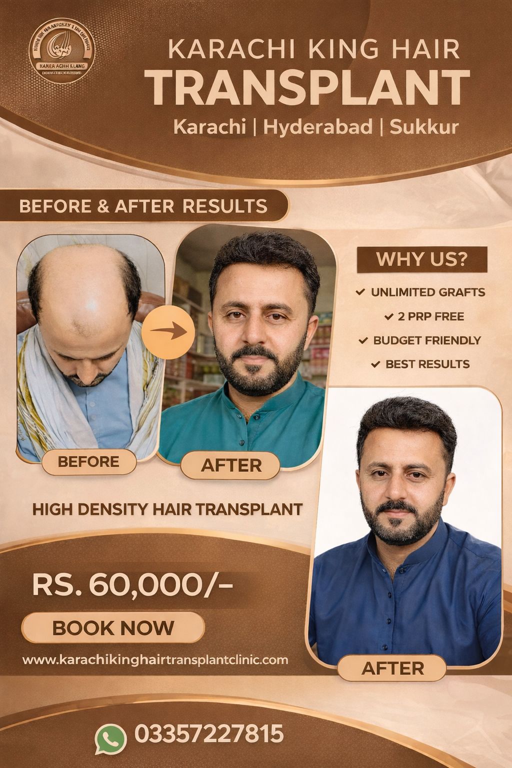 Karachi king skin care & hair transplant Facebook ad