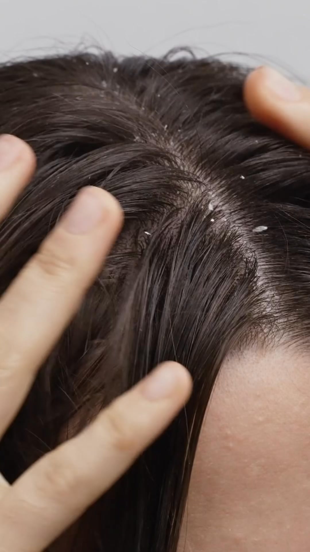 Be Bodywise - UAE Facebook ad: Treat Dandruff at the Root