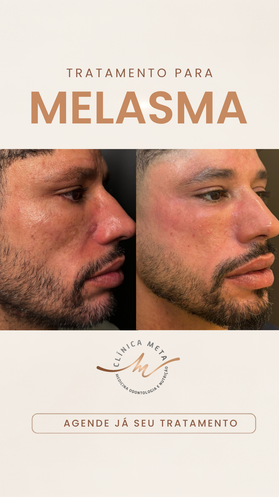 Clínica META - Medicina Integrativa e Estética Facebook ad from Jul 6, 2026