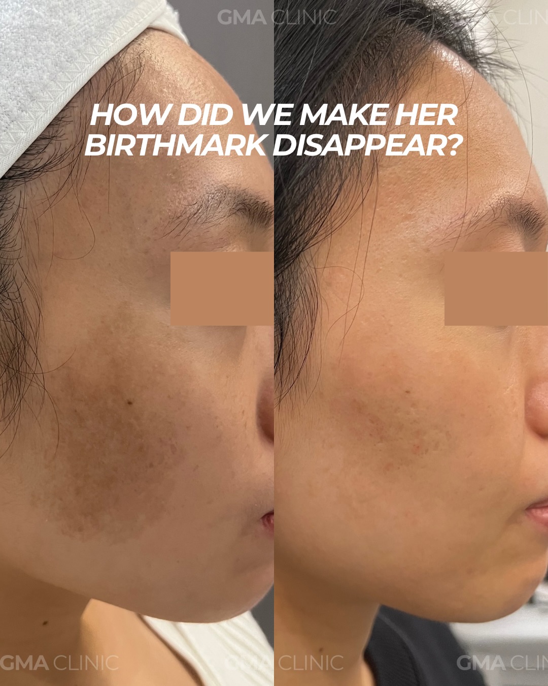 GMA Clinic Facebook ad