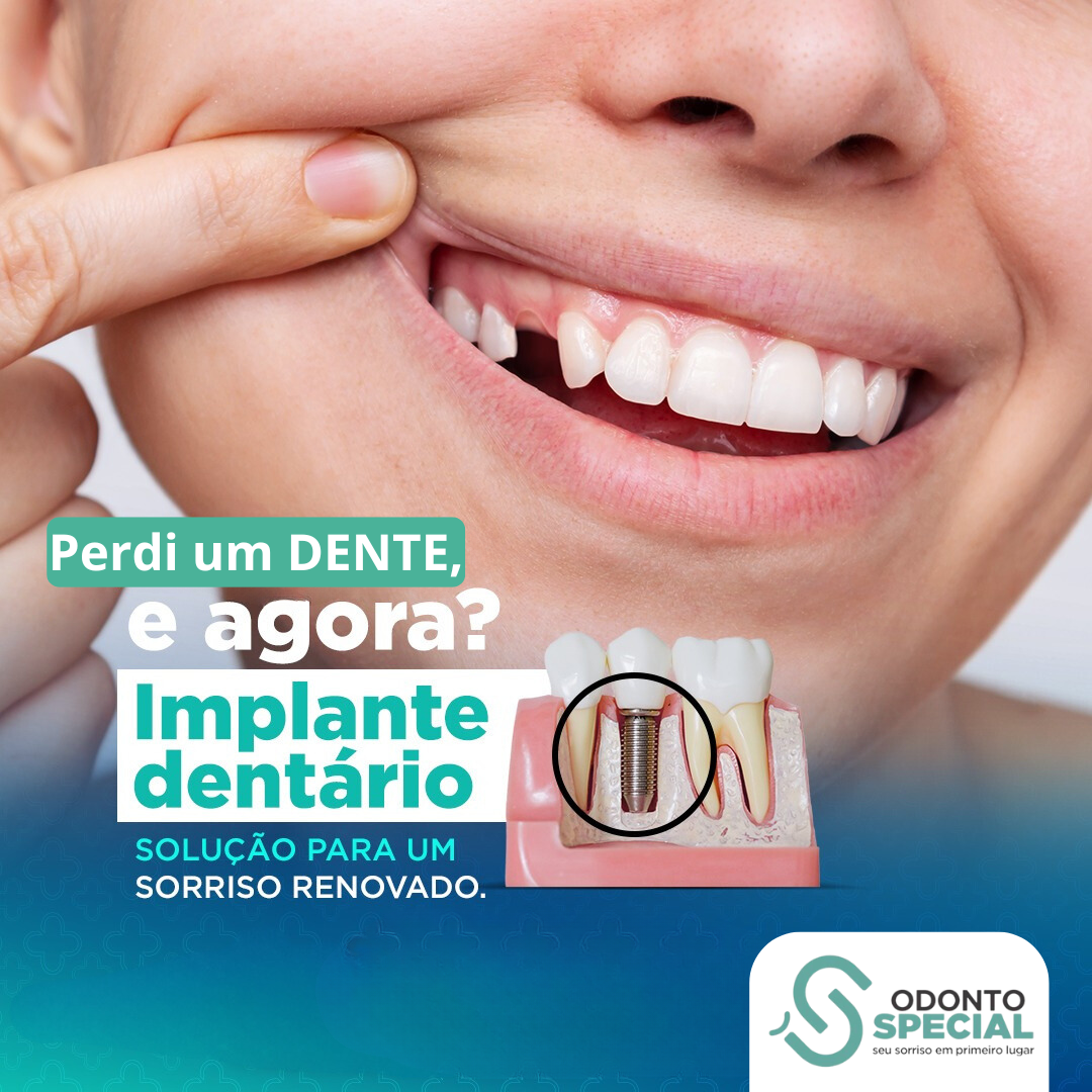 Odonto Special Ipatinga Facebook ad: Converse conosco