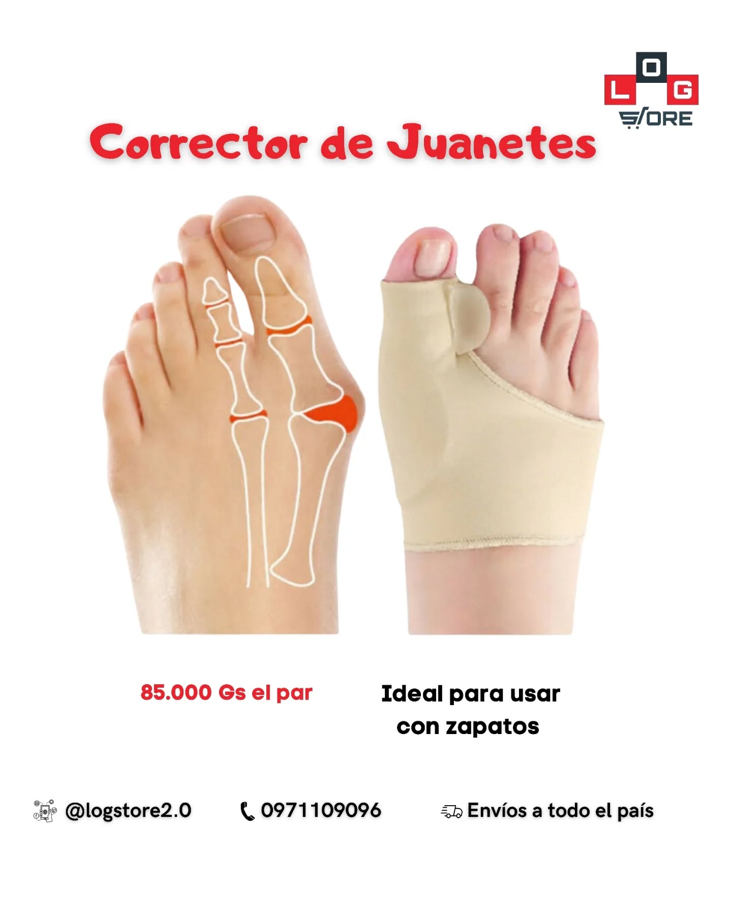 LOG Store Facebook ad: El corrector de juanetes de tela es un…
