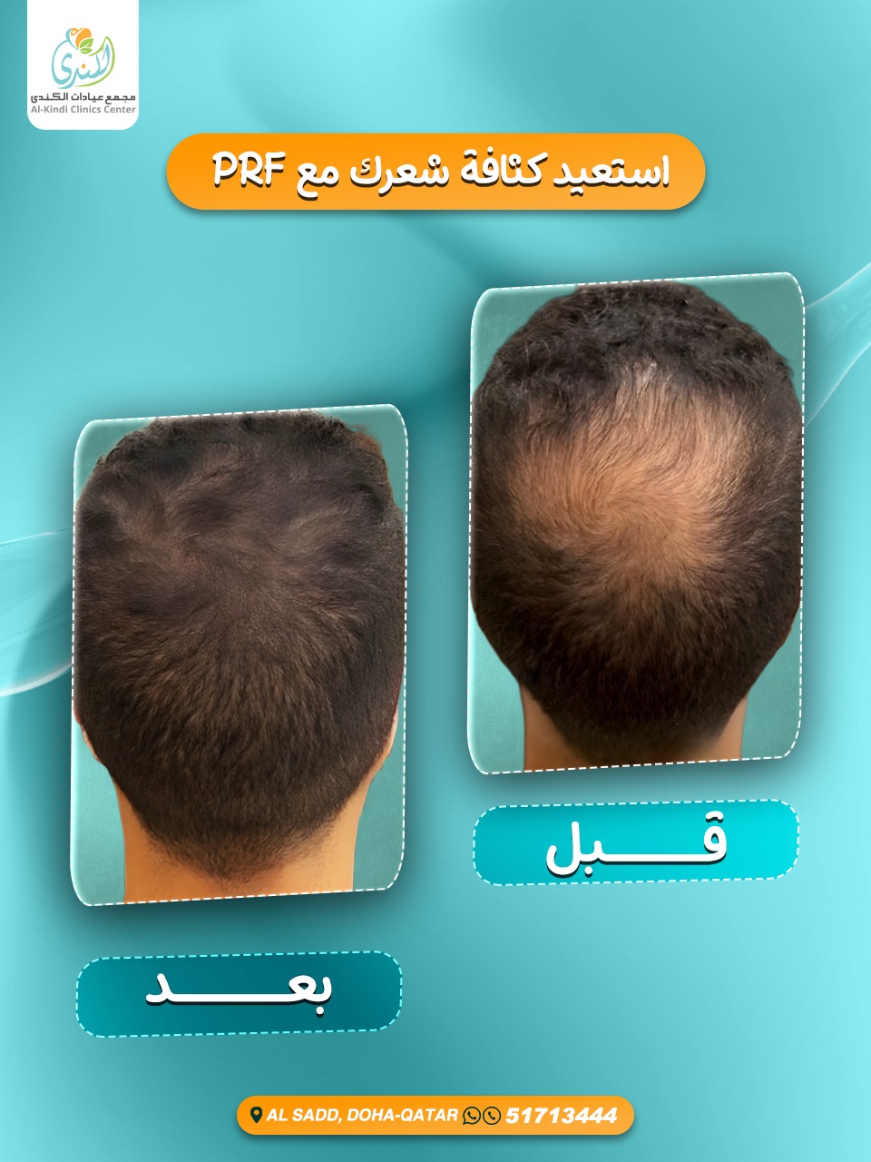 Alkindi_Clinics مركز_الكندي_الطبي Facebook ad: Chat with us