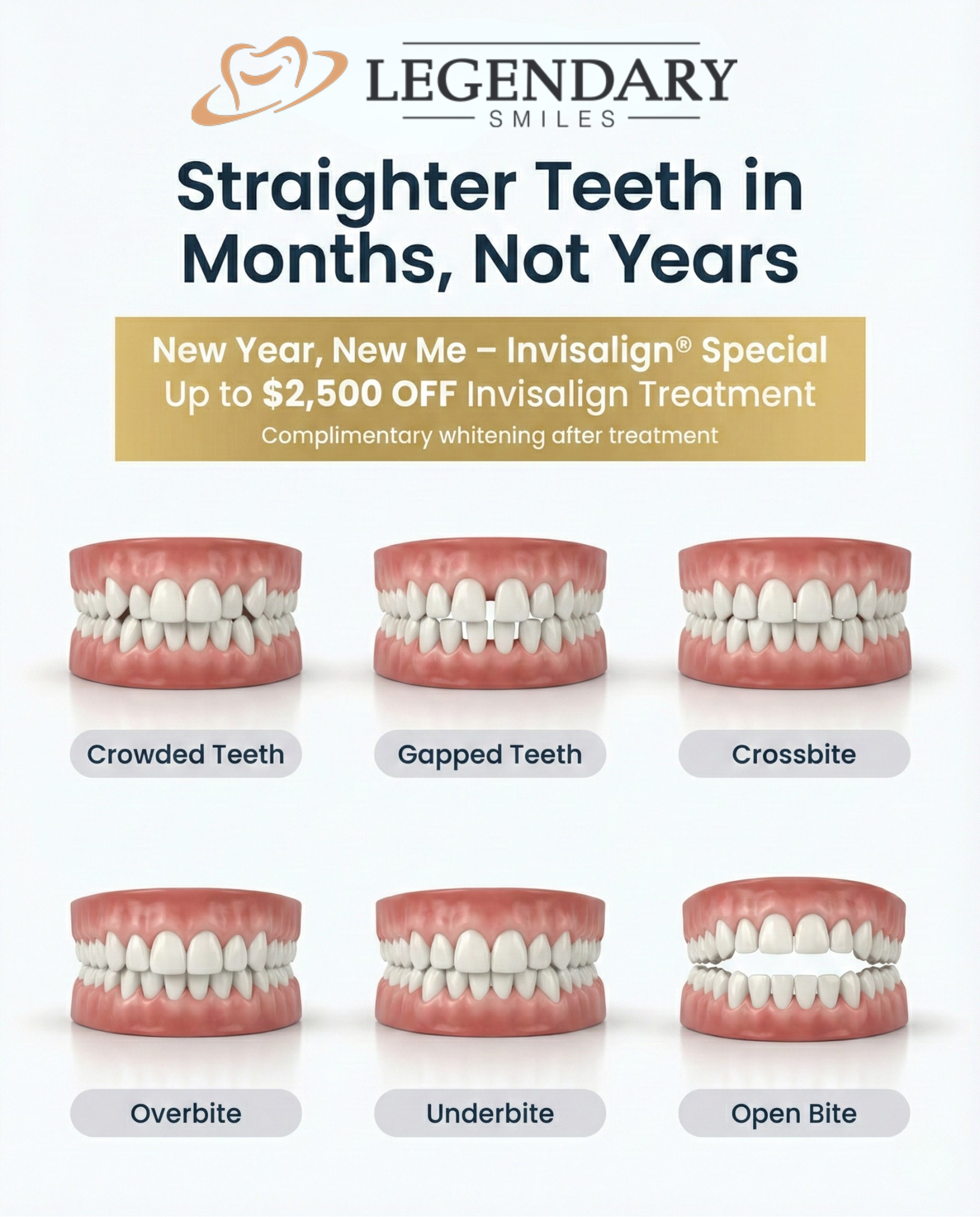 Legendary Smiles Havertown Facebook ad: $2500 OFF Invisalign Special Is Here!