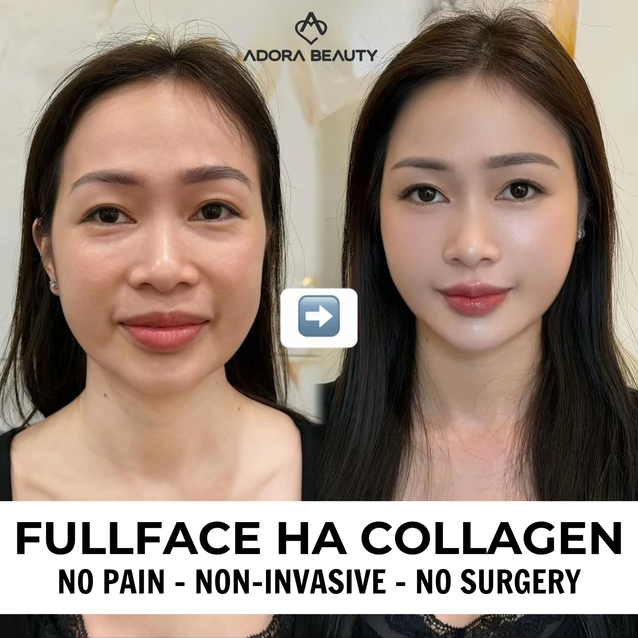 ADORA International Aesthetic Institute - Manila Branch Facebook ad