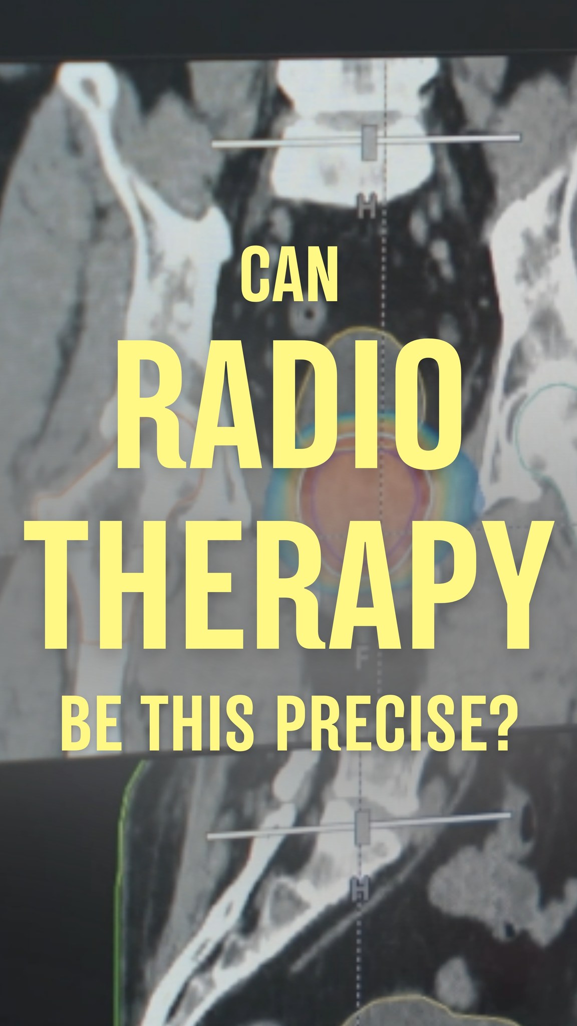 Pantai Hospital Kuala Lumpur Facebook ad: What if your radiotherapy could continuously adapt to…